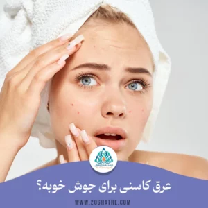 عرق کاسنی برای جوش