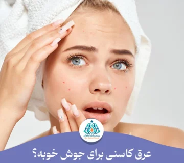 عرق کاسنی برای جوش