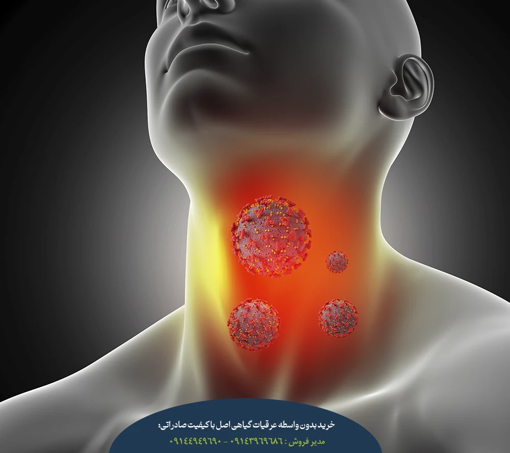 علل و انواع گلو دردگلو درد چیست؟ 