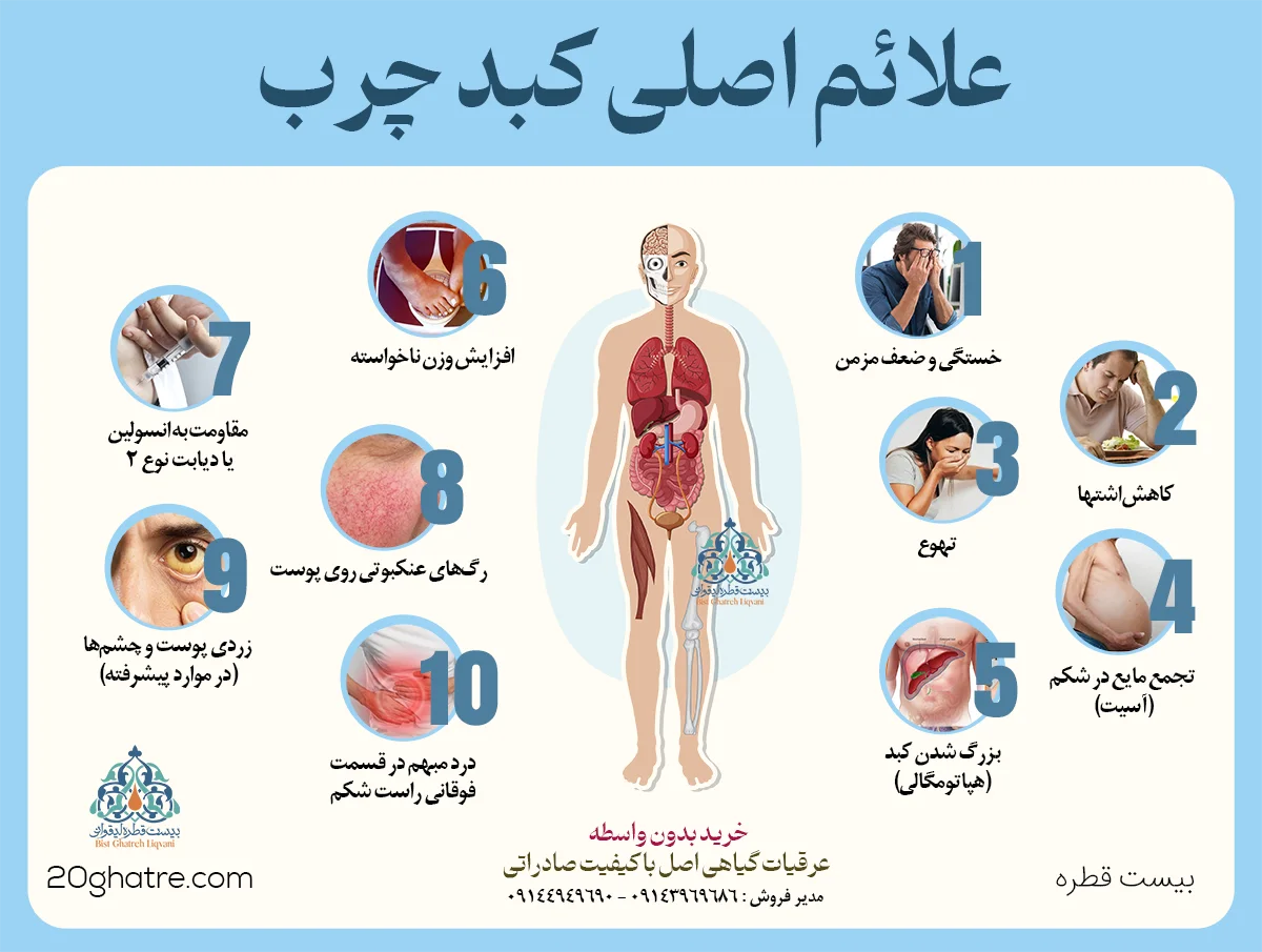 علائم کبد چرب